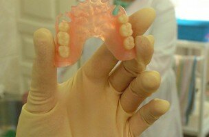 Съемные зубные протезы: плюсы и минусы